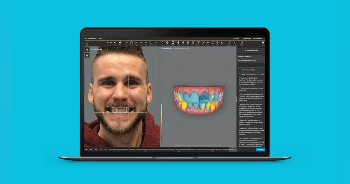 3D Smile Technology: Advantages for Veneers and Invisalign Treatments 3D Smile Technology